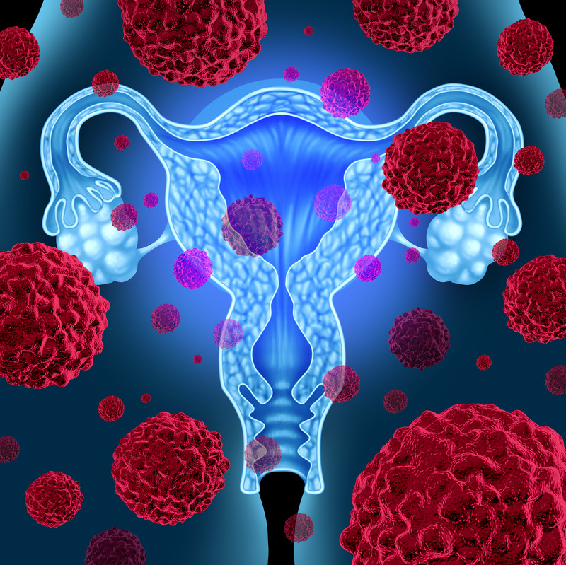 uterine-cancer-screening-means-knowing-your-risk-factors-screening